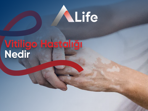 Vitiligo Hastalığı Nedir?